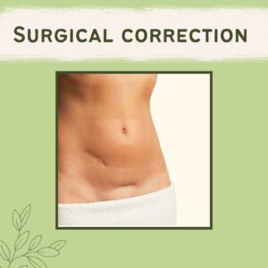 Surgical Correction, Pressure Garments Therapy, Excision Surgery, Gandhidham, Prayagraj, Ahmednagar, Surat, India.