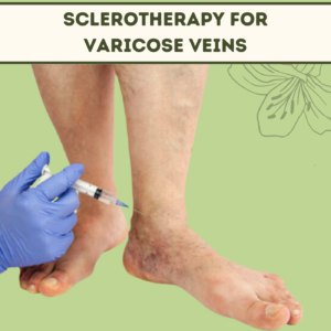 Sclerotherapy For Varicose Veins, Laser Treatment, Spider Veins, Himatnagar, Bhilwara, Satara, Surat, India. 